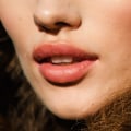 Is there a downside to lip fillers?