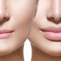 Will people notice 0, 5 ml lip fillers?