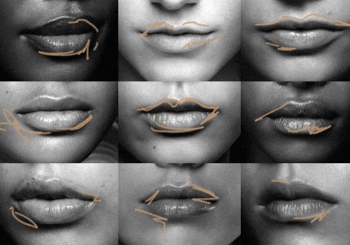 What happens to your lips when you stop getting lip fillers?