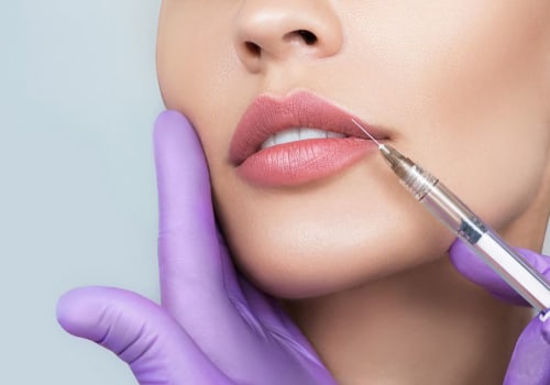 A Complete Guide to Aftercare Instructions for Lip Fillers