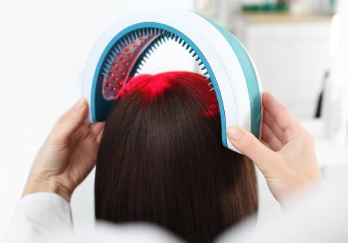 A Comprehensive Look at Low-Level Laser Therapy for Hair Loss