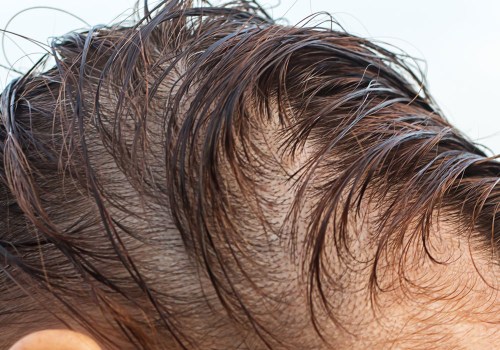 Vitamin D for Hair Growth: How to Enhance Your Locks Naturally