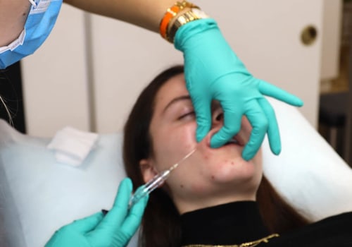 Understanding Cannula Injections for Lip Augmentation