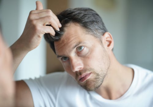 Hormonal Changes and Male Pattern Baldness: Understanding the Causes and Risks