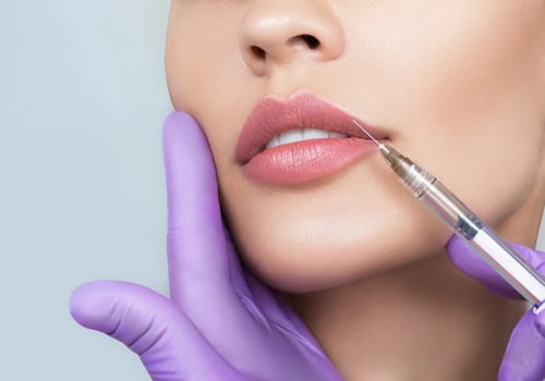 How much is a syringe for lip fillers?